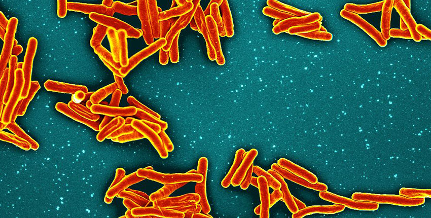 A close up of tuberculosis